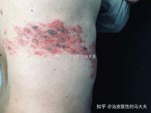 马病图片,图解解析